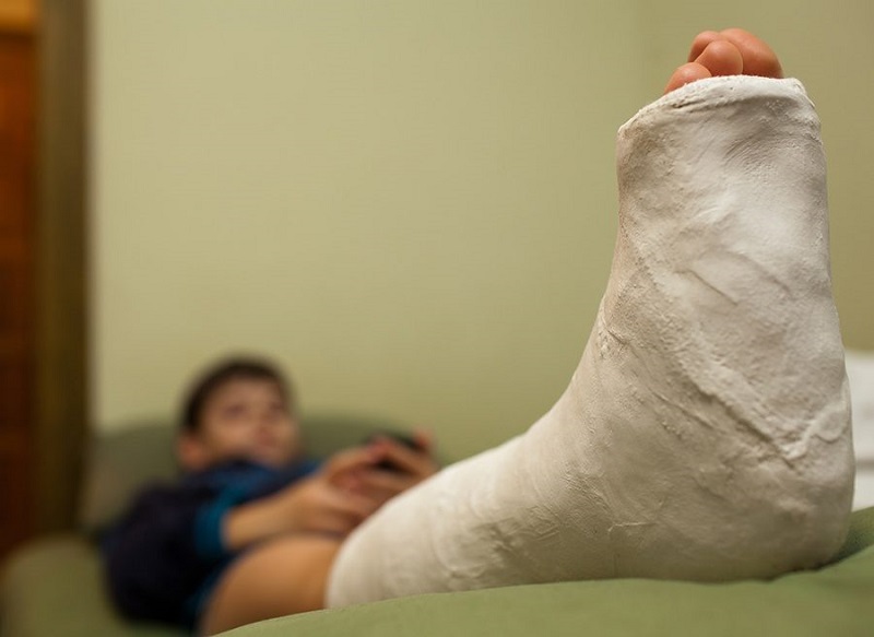 Перелом ноги у детей фото
