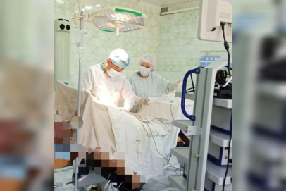 В Ташле хирурги успешно удалили пациенту пятилетнюю опухоль на лбу