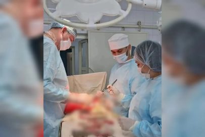 Оренбургские хирурги успешно прооперировали пациентку с тяжелым внутренним кровотечением